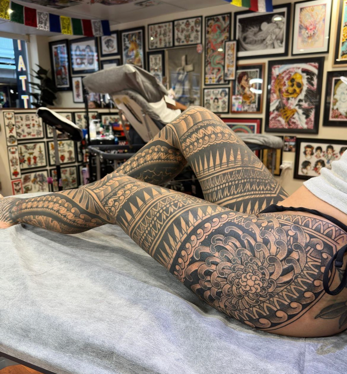 Healed Leg and Arm Bodysuit