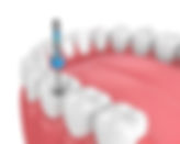 rct_edited.jpg