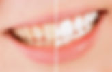 BLEACHING_edited.jpg