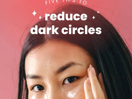 Five Tips to Reduce Dark Circles
