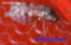 The CDC and Health Canada recommend seeking medical advice if symptoms worsen, such as increased redness, swelling, or pain, or if signs of infection appear, like pus, red streaks, or fever (especially above 100°F/37.7°C). Emergency care is urged for severe reactions, such as difficulty breathing or widespread rash, though these are rare with noseeum bites.