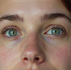 Rinoplastia para mejorar respiración: Entendiendo la Rinoplastia Funcional en Jalisco