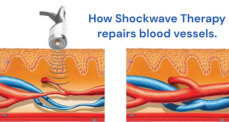 bloodvessels (1)-1.jpg
