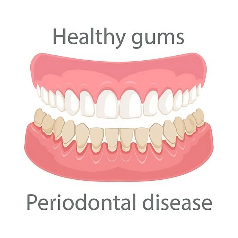 GUM THERAPY