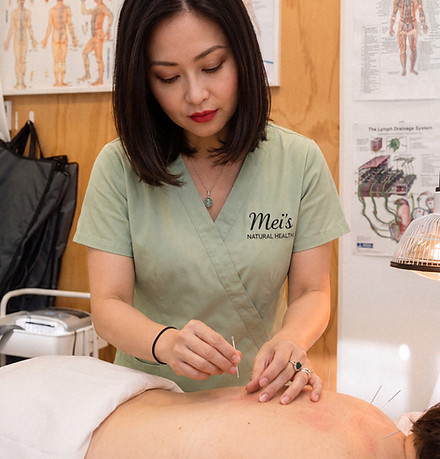 Acupuncture - Mei's natural health Auckland.jpg