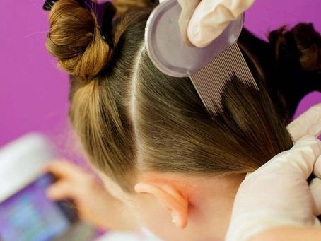 Cómo elminar piojos de la cabeza: Guía Completa Paso a Paso