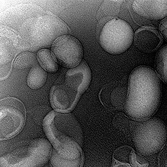 Liposome_400x300_edited.png