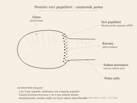 penisin inci papülleri