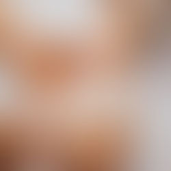 Close-up of a hand receiving a ketamine therapy, held gently by another hand. Soft lighting and a medical setting. Calm and careful mood.