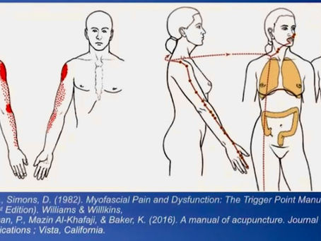 How is Acupuncture Different Than Dry Needling?