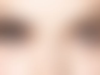 Allergic Reaction to Eyelash Extensions: Signs, Causes & What to Do