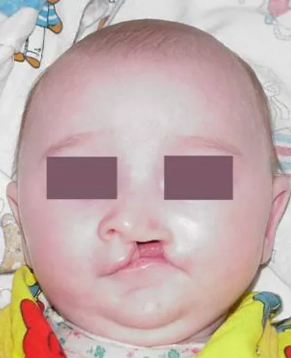 sindrom van der vuda institut gonchakova