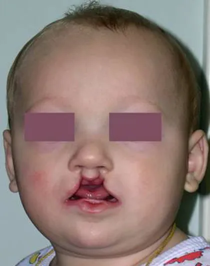 sindrom van der vuda institut gonchakova