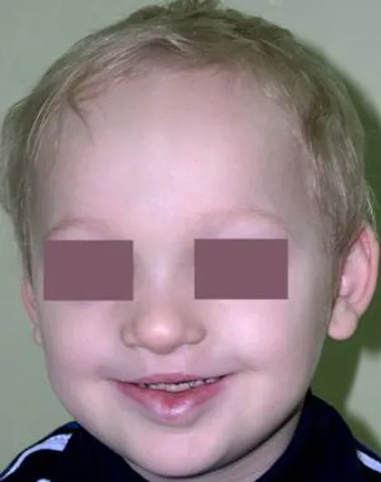 sindrom van der vuda institut gonchakova