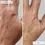 Thumbnail: Omnilux Contour Glove
