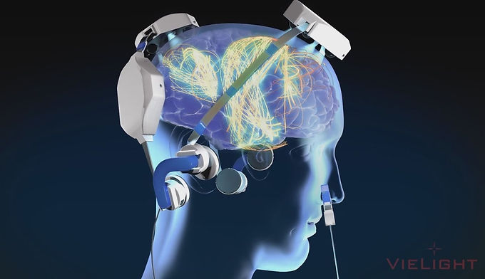 Photobiomodulation: Radiant Intervention for Stress in Epilepsy (PBM RISE)