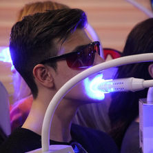 Tooth whitening/bleaching