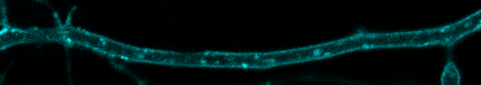 signalling endosome transport in DRG neuron