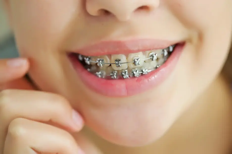 Orthodontics_hero_SmileZone.webp