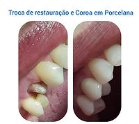 %F0%9F%92%8EMais%20um%20caso%20conclu%C3