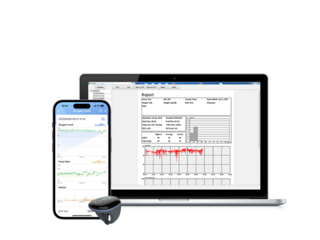 The Role of Oxygen Monitoring in Managing Sleep Apnea