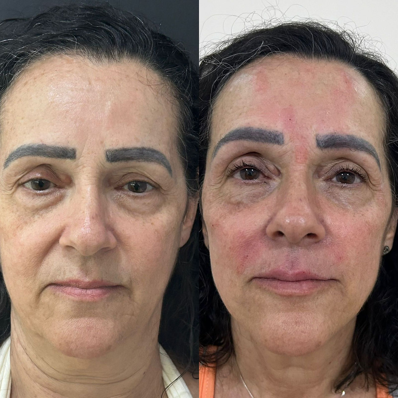 cirurgia buco-maxilo-facial Rio de Janeiro