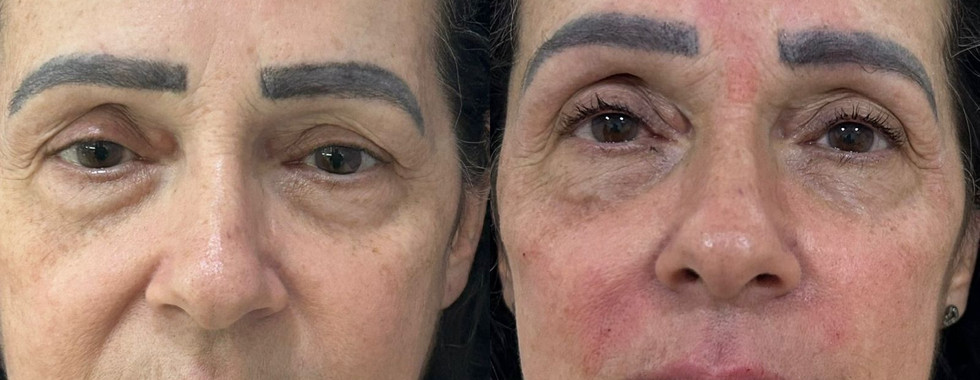 cirurgia buco-maxilo-facial Rio de Janeiro