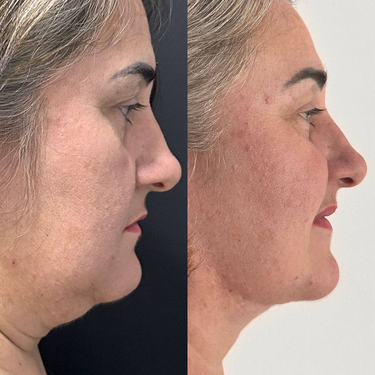 cirurgia buco-maxilo-facial Rio de Janeiro