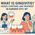 What Is Gingivitis? Causes, Symptoms, and Treatment in Garden City, NY