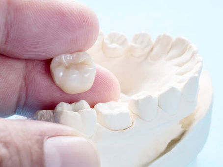 6 Things to Know Before Getting a Dental Crown