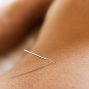 Gros plan d'une aiguille d'acupuncture