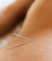Acupuncture femme Réception