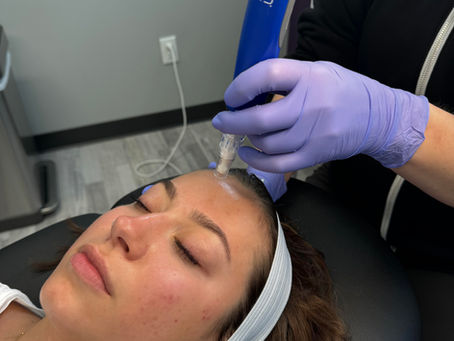 Summer Smart: Sun-Protective Habits That Keep Your Skin Healthy and Youthful