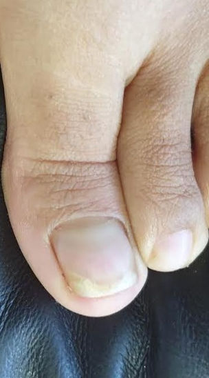 Ram Horn Nail After.jpeg