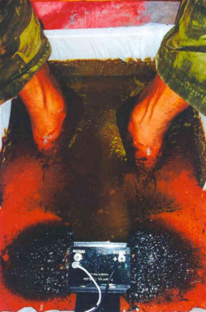 Detoxification Image