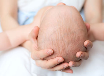 Sesión Osteopatía Bebés