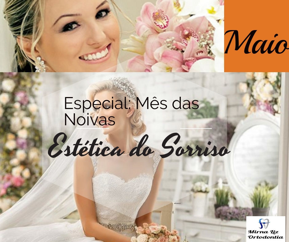 A estética do sorriso para noivas