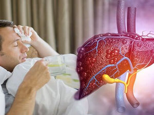 รู้ทัน 3 โรคตับที่เป็นง่าย…แต่หายยาก