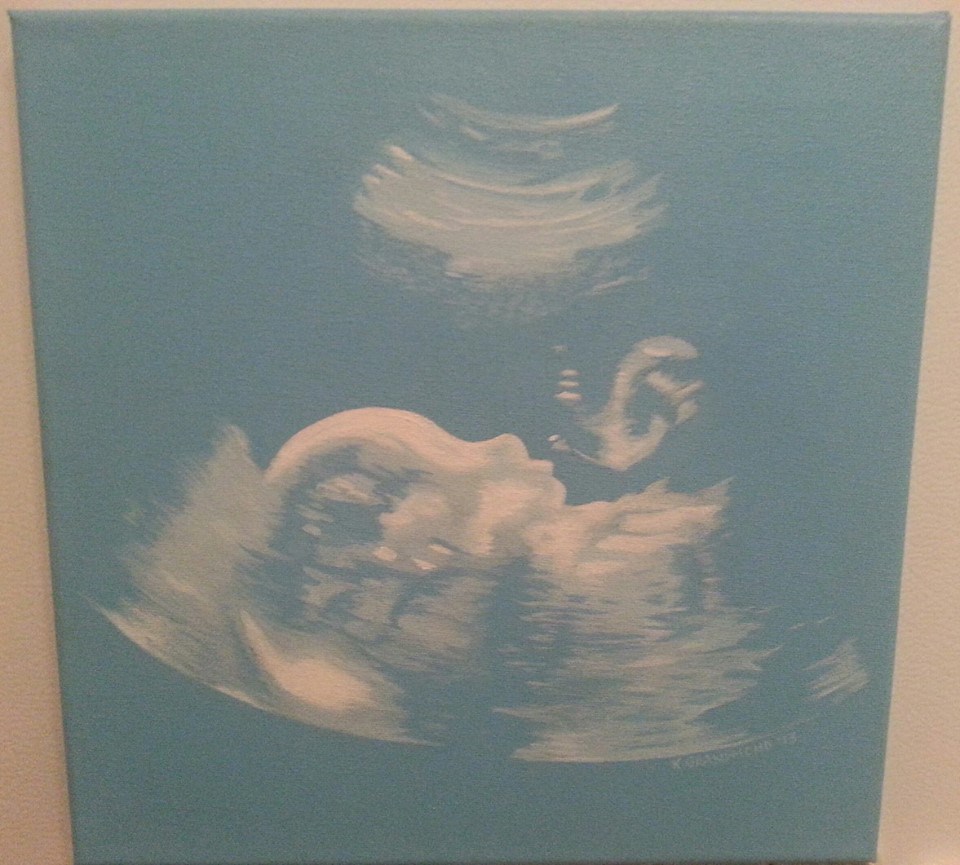 ULTRASOUND