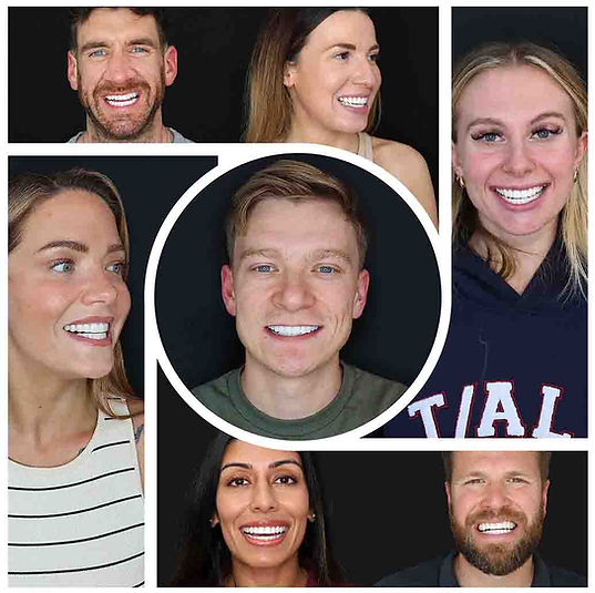 Smile makeover results