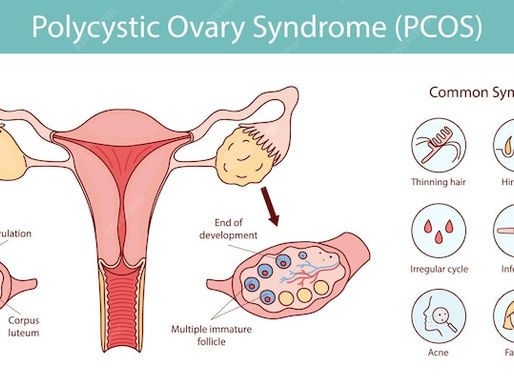 PCOS