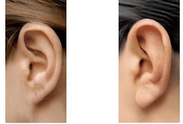 Earlobes.jpg