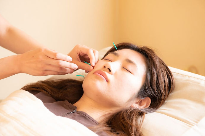 Beauty acupuncture, Japanese female2.jpeg