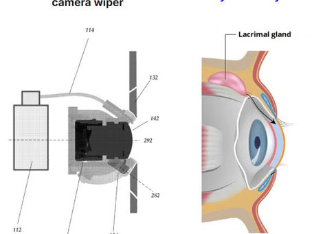 When engineers look at human anatomy