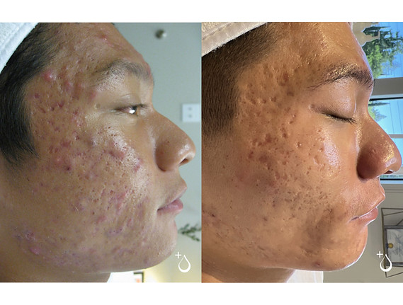 before and after robertt.jpeg