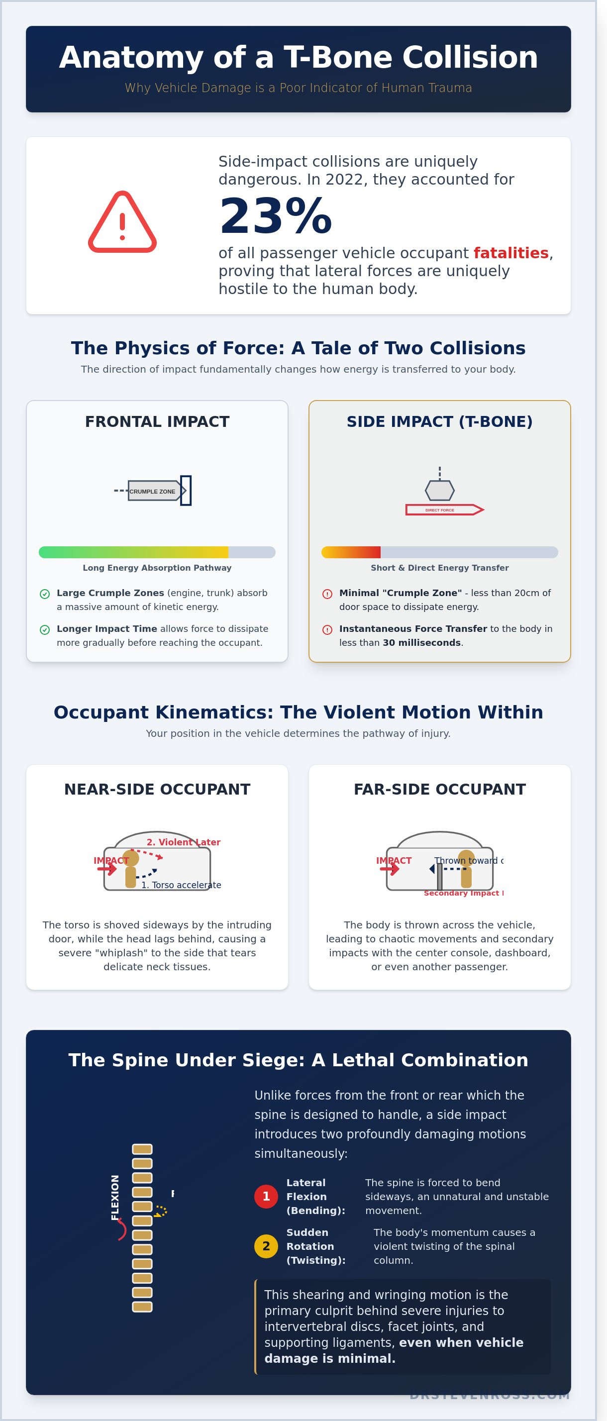 T-bone accident injury analysis