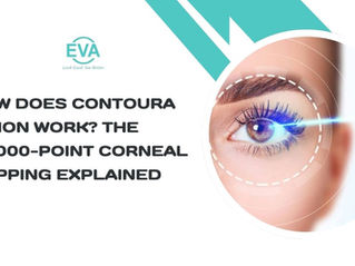 How Does Contoura Vision Work? The 22,000-Point Corneal Mapping Explained