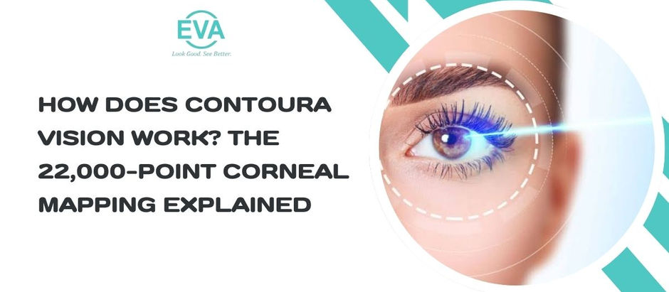 How Does Contoura Vision Work? The 22,000-Point Corneal Mapping Explained