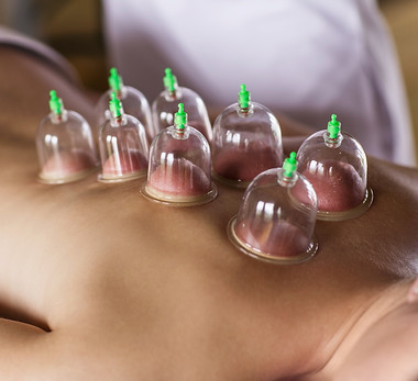 Cupping