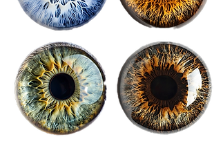 different coloured eyes 